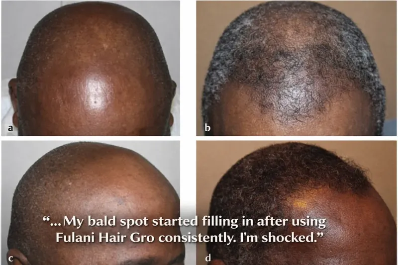 Before and After Results 6